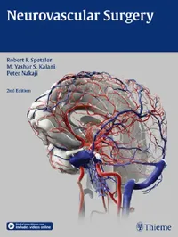 Buy Neurovascular Surgery (English, Robert F. Spetzler | M. Yashar Kalani | Peter Nakaji) — BookShops.in
