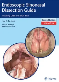 Buy Endoscopic Sinonasal Dissection Guide (English, Roy R. Casiano | Islam Herzallah | Jean Eloy) — BookShops.in