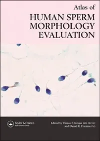 Buy Atlas of Human Sperm Morphology Evaluation (English, Kruger Thinus F. | Daniel R. Franken) — BookShops.in