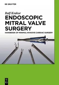 Buy Endoscopic Mitral Valve Surgery (English, Ralf Krakor) — BookShops.in