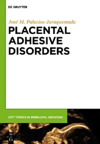 Buy Placental Adhesive Disorders (English, José Miguel Palacios-Jaraquemada) — BookShops.in