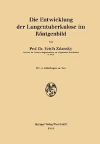Buy Die Entwicklung Der Lungentuberkulose Im Röntgenbild (English, Erich Zdansky) — BookShops.in
