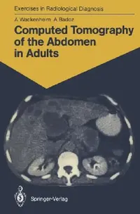 Buy Computed Tomography of the Abdomen in Adults (English, Auguste Wackenheim | M. -T Wackenheim | Armelle Badoz) — BookShops.in