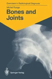 Buy Bones and Joints (English, Michel Runge | Marie-Therese Wackenheim) — BookShops.in
