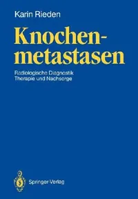 Buy Knochenmetastasen (English, Karin Rieden) — BookShops.in