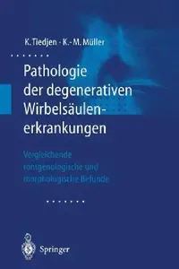 Buy Pathologie Der Degenerativen Wirbelsäulenerkrankungen (English, Kay Tiedjen | Klaus-Michael Müller) — BookShops.in