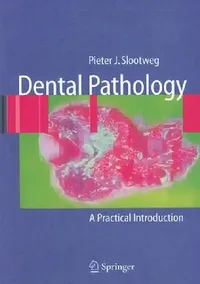Buy Dental Pathology (English, Pieter J. Slootweg) — BookShops.in