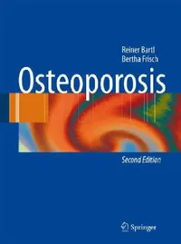 Buy Osteoporosis (English, Reiner Bartl | Bertha Frisch) — BookShops.in