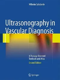 Buy Ultrasonography in Vascular Diagnosis (English, Wilhelm Schäberle | B. Herwig) — BookShops.in