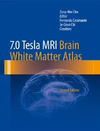 Buy 7.0 Tesla MRI Brain White Matter Atlas (English, Zang-Hee Cho | Fernando Calamante | Je-Geun Chi) — BookShops.in