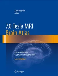 Buy 7.0 Tesla MRI Brain Atlas (English, Zang-Hee Cho) — BookShops.in