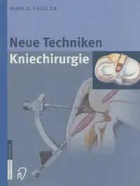 Buy Neue Techniken Kniechirurgie (English, H. H. Pässler | H. Thermann) — BookShops.in
