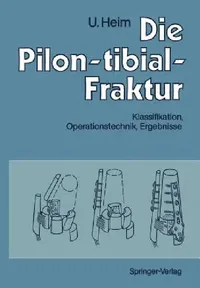 Buy Die Pilon-tibial-Fraktur: Klassifikation, Operationstechnik, Ergebnisse | by A. Gächter | Urs Heim | M. Allgöwer | ‎ Springer-Verlag Berlin and Heidelberg GmbH & Co. K | ‎ German | ‎ Softcover reprint of the original 1st ed. 1991 Edition — BookShops.in