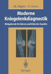 Buy Moderne Kniegelenkdiagnostik (English, Matthias Nägele | R. W. Günther | Gerhard Adam) — BookShops.in