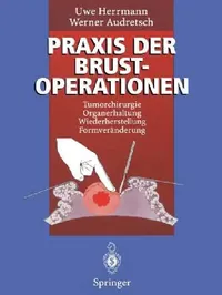 Buy PRAXIS Der Brustoperationen | by Uwe Herrmann | Werner Audretsch | Springer | by Uwe Herrmann | Werner Audretsch | Springer | by Uwe Herrmann | Werner Audretsch | Springer | by Uwe Herrmann | Werner Audretsch | Springer | by Uwe Herrmann | Werner Audretsch | Springer | by Uwe Herrmann | Werner Audretsch | Springer | by Uwe Herrmann | Werner Audretsch | Springer | by Uwe Herrmann | Werner Audretsch | Springer | by Uwe Herrmann | Werner Audretsch | Springer | by Uwe Herrmann | Werner Audretsch | S — BookShops.in
