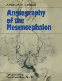 Buy Angiography of the Mesencephalon (English, Auguste Wackenheim | Jean Paul Braun) — BookShops.in