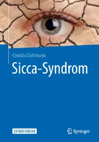 Buy Sicca-Syndrom (English, Cordula Dahlmann) — BookShops.in