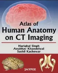 Buy Atlas Of Human Anatomy On Ct Imaging (English, Hariqbal Singh) — BookShops.in