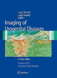 Buy Imaging of Urogenital Diseases (English, Lucio Olivetti | Luigi Grazioli) — BookShops.in