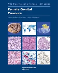 Buy Female Genital Tumours (English, Who Classification of Tumours Editorial) — BookShops.in