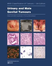 Buy Urinary and Male Genital Tumours (English, Who Classification of Tumours Editorial) — BookShops.in