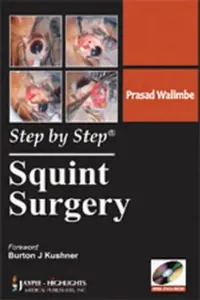 Buy Step By Step Squint Surgery (English, Prasad Walimbe) — BookShops.in