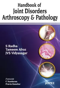 Buy Handbook Of Joint Disorders Arthroscopy & Pathology (English, S Radha) — BookShops.in