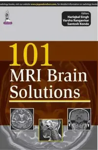 Buy 101 Mri Brain Solutions (English, Hariqbal Singh) — BookShops.in