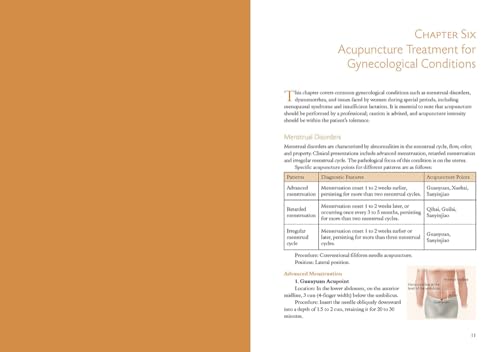A Beginner’s Guide to Acupuncture: Treating Common Ailments Through Traditional Chinese Medicine view 6