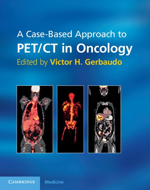 Buy A Case-Based Approach to PET/CT in Oncology by Gerbaudo — BookShops.in