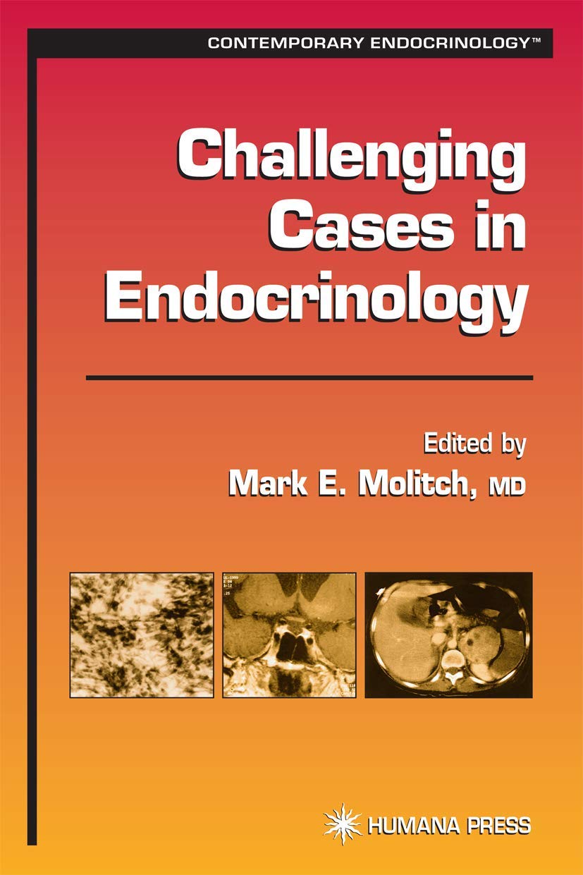 Buy Challenging Cases in Endocrinology (Contemporary Endocrinology) — BookShops.in