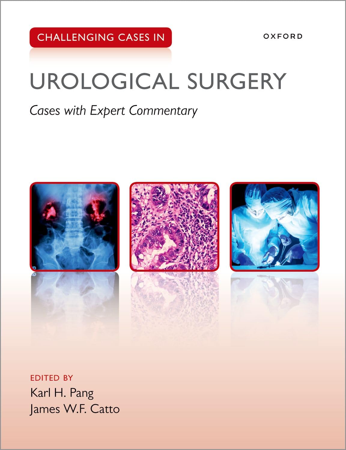 Buy Challenging Cases in Urological Surgery by Karl Pang — BookShops.in