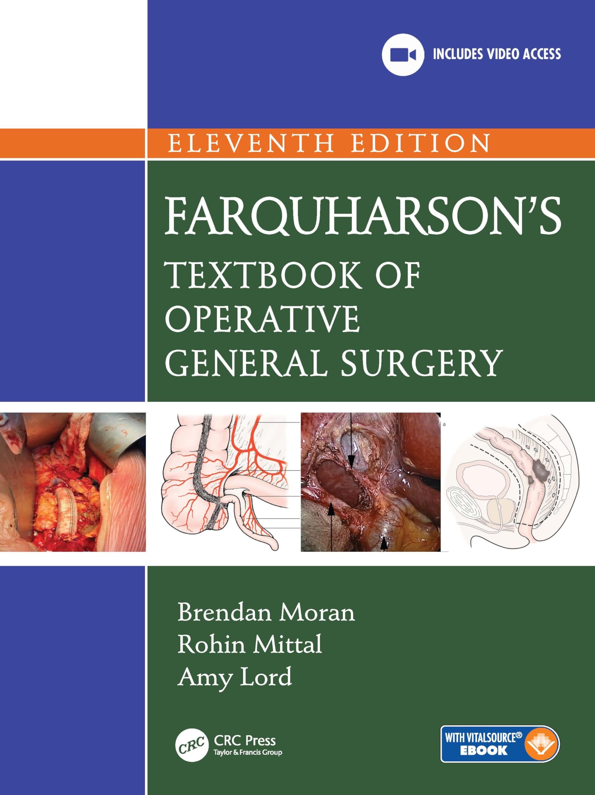 Buy Farquharson's Textbook of Operative General Surgery by Moran Brendan — BookShops.in