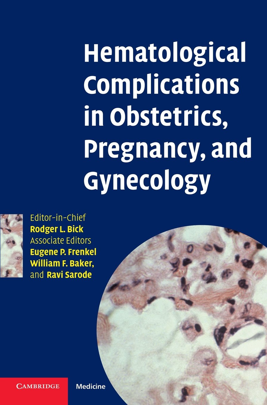 Buy Hematological Complications in Obstetrics by Bick — BookShops.in