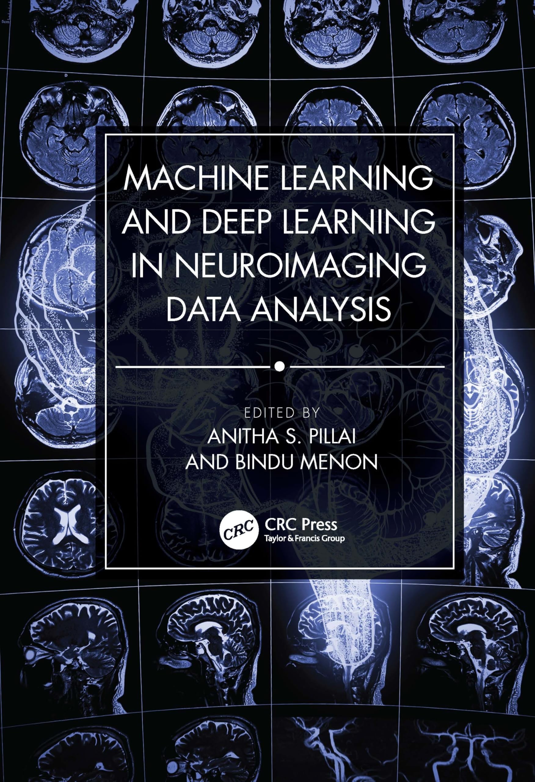Buy Machine Learning and Deep Learning in Neuroimaging Data Analysis (English, Anitha S. Pillai | Bindu Menon) — BookShops.in