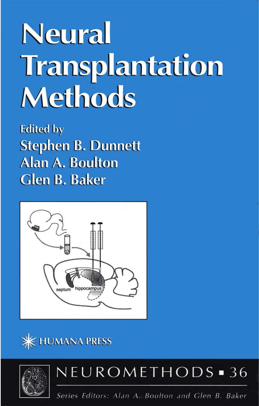 Buy NEURAL TRANSPLANTATION METHODS: 36 (Neuromethods) — BookShops.in