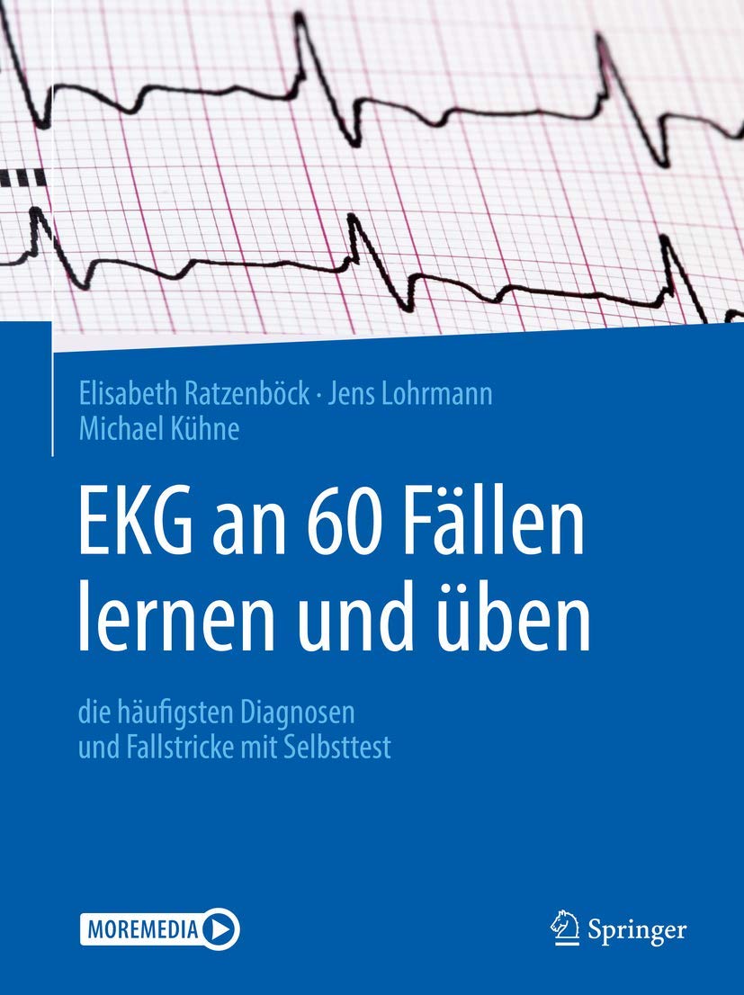 Buy EKG an 60 Fällen Lernen und Üben by Ratzenböck — BookShops.in