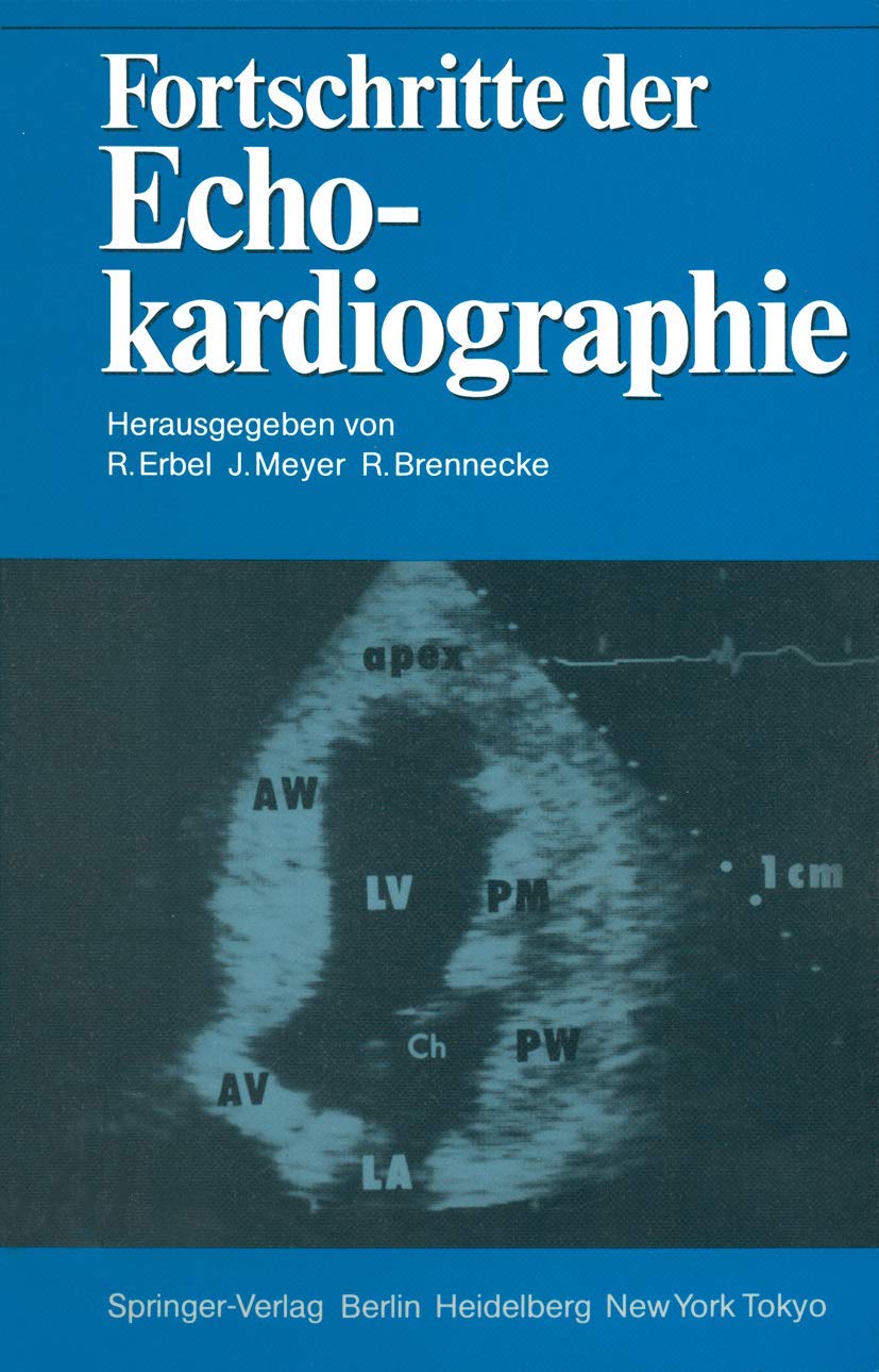 Buy Fortschritte der Echokardiographie by Raimund Erbel | Jürgen — BookShops.in