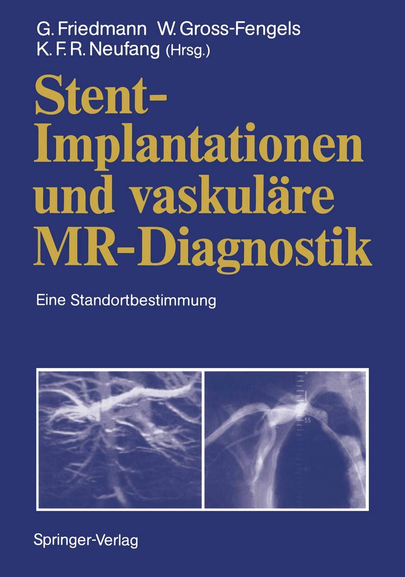 Buy Stent-Implantationen und vaskuläre MR-Diagnostik: Eine Stand — BookShops.in