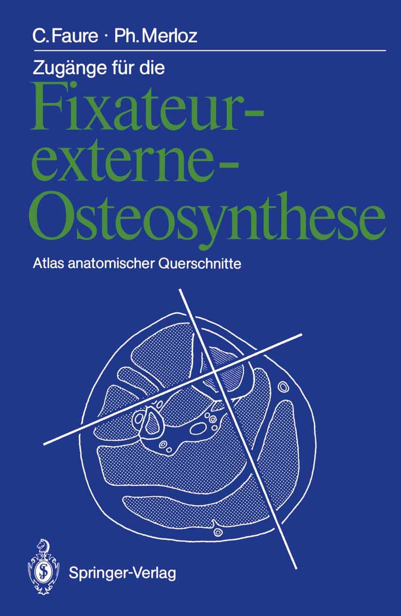 Buy Zugänge für die Fixateur-externe-Osteosynthese: Atlas anatom — BookShops.in