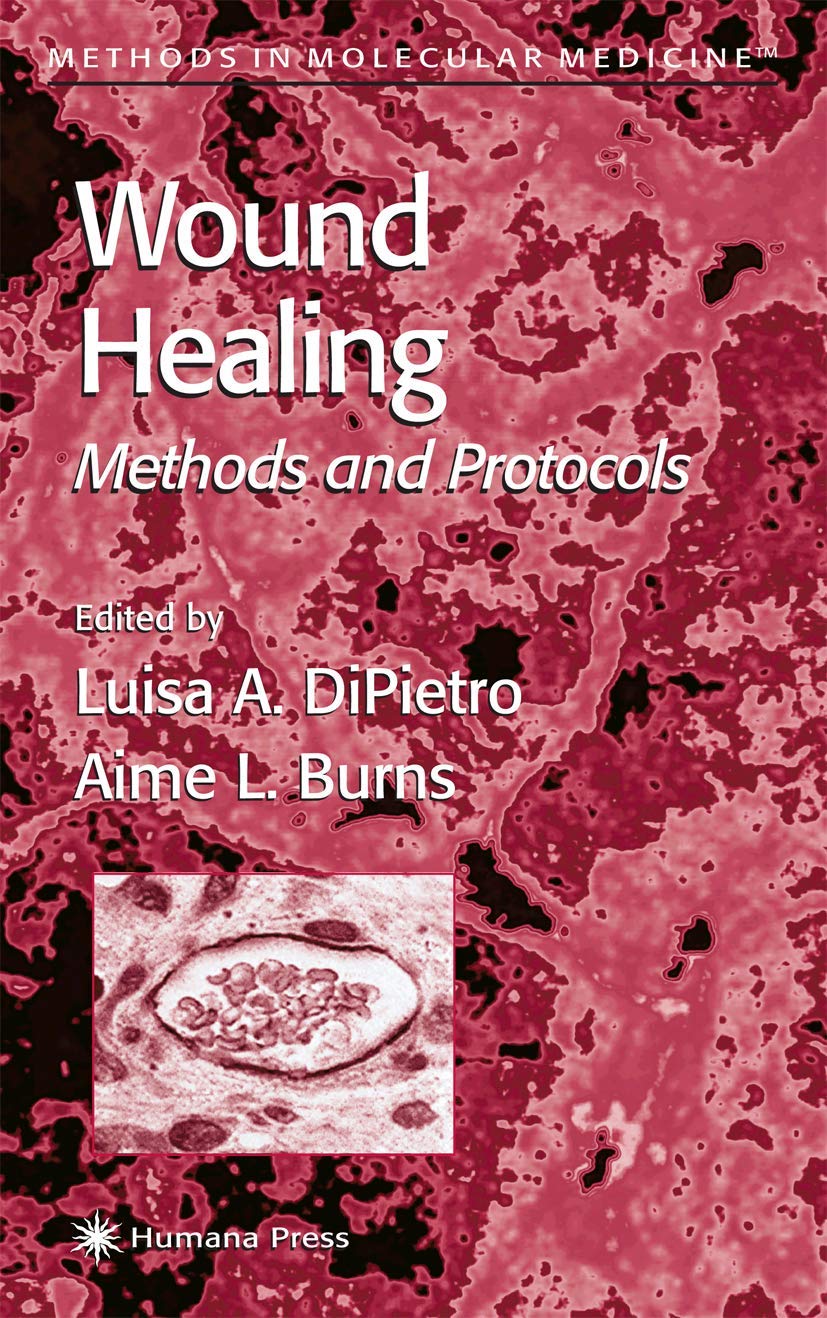 Buy Wound Healing: Methods and Protocols by Luisa A. DiPietro — BookShops.in