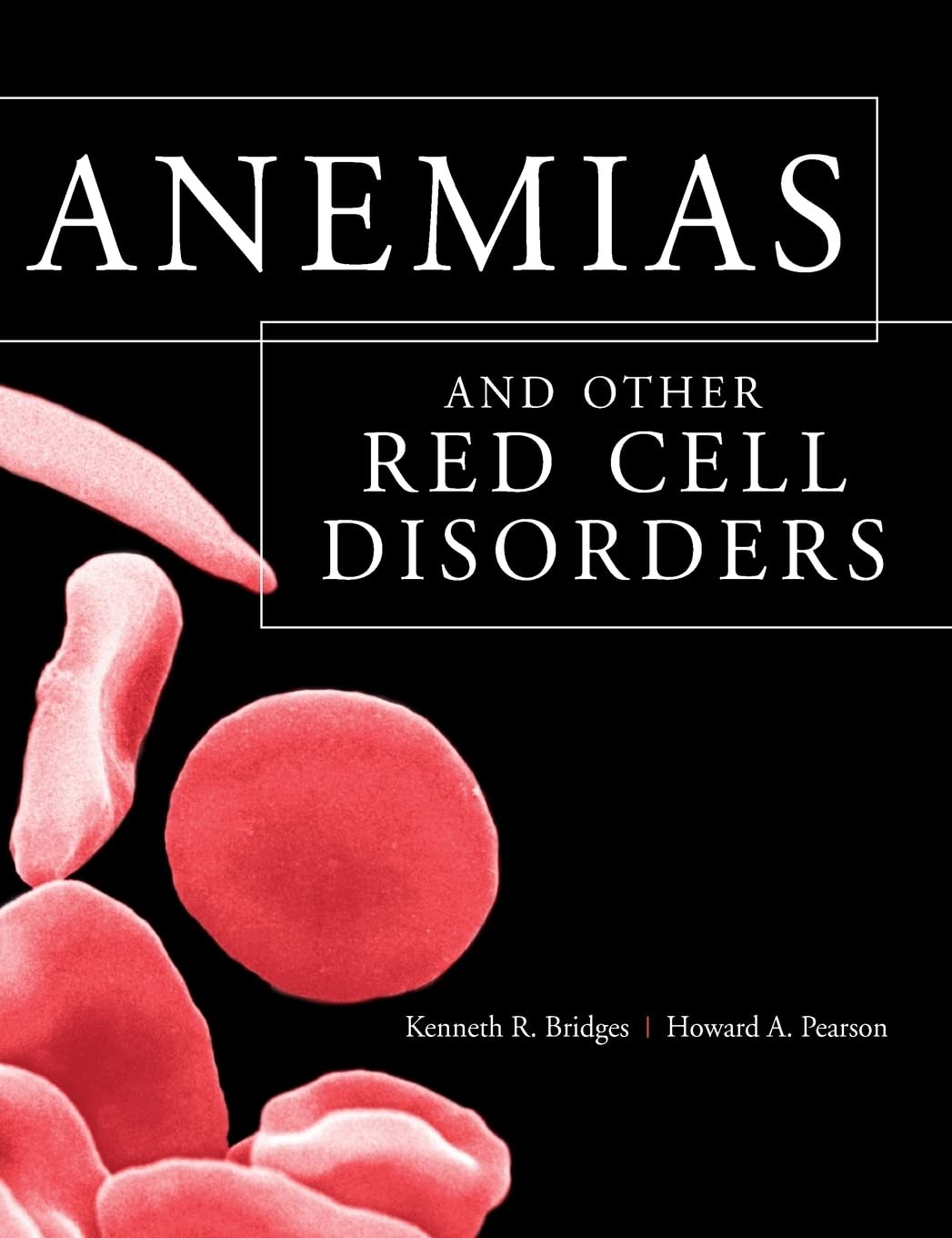 Buy Anemias and Other Red Cell Disorders by Kenneth Bridges & Howard A. Pearson (HB 2008) – McGrawHill, English, Paperback, Standard Edition – Bookshops.in — BookShops.in