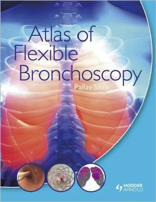 Buy Atlas of Flexible Bronchoscopy by Shah Pallav | Taylor & Francis | Hardcover 2011 Edition | Respiratory Medicine Guide — BookShops.in