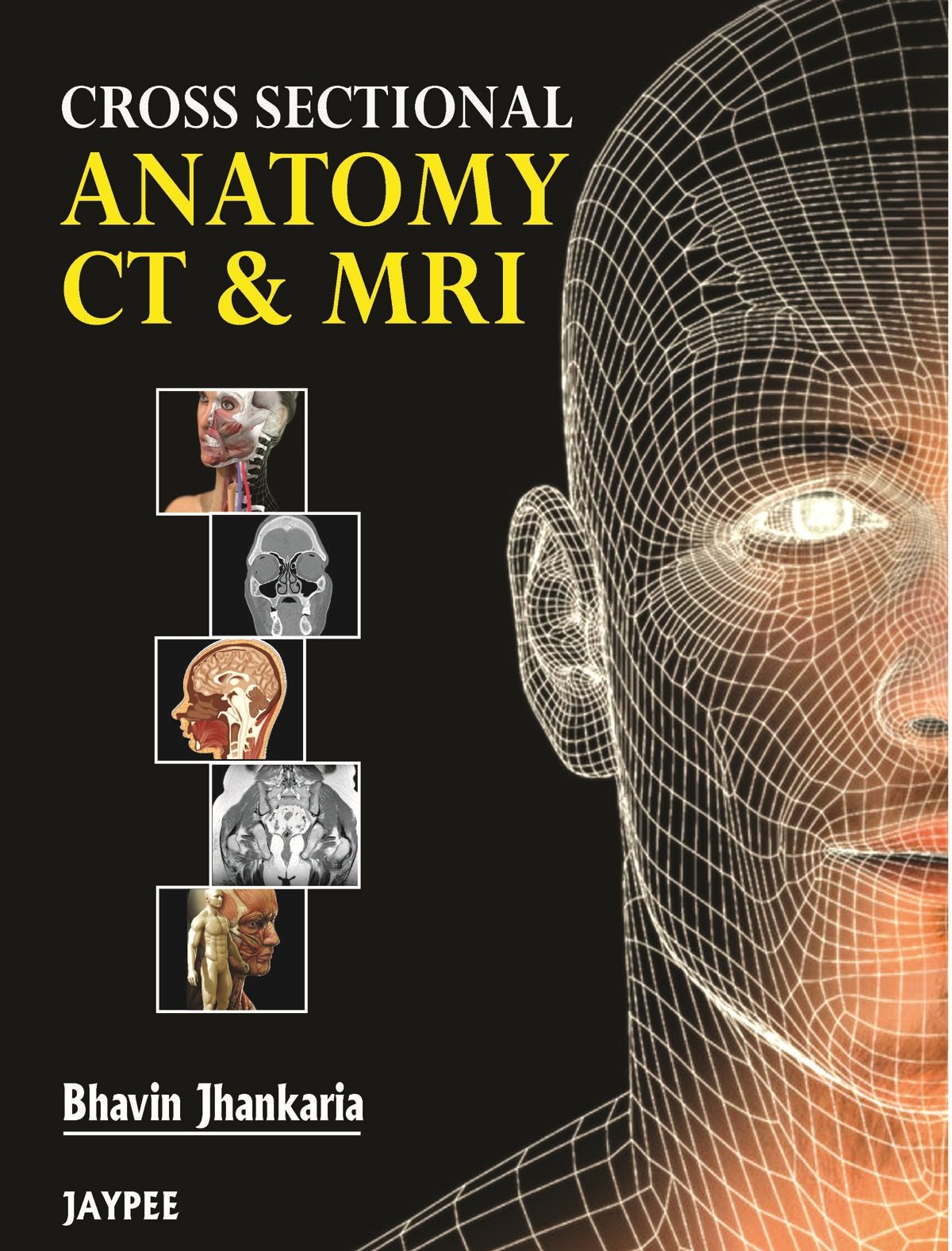 Buy Cross Sectional Anatomy CT & MRI by Govind B Chavhan | Jaypee Brothers | Hardcover | 1st Edition | Radiology & Nuclear Medicine Textbook — BookShops.in