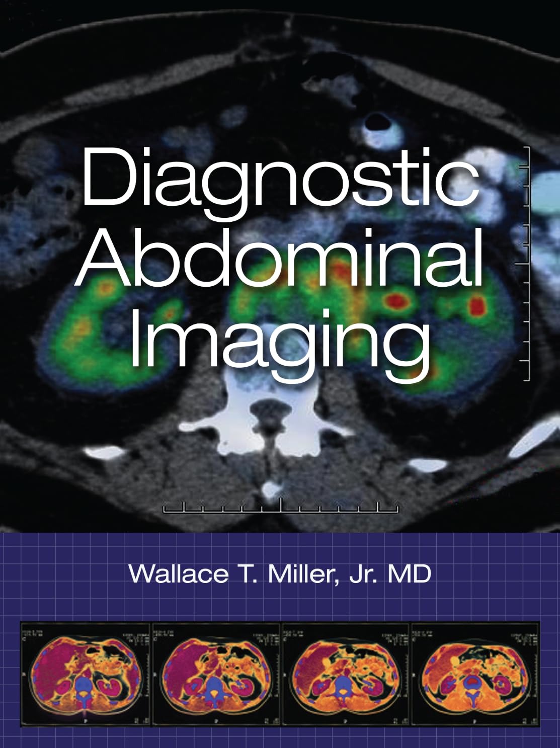 Buy Diagnostic Abdominal Imaging by Wallace T. Miller | McGraw-Hill | English | Paperback | Illustrated Edition — BookShops.in