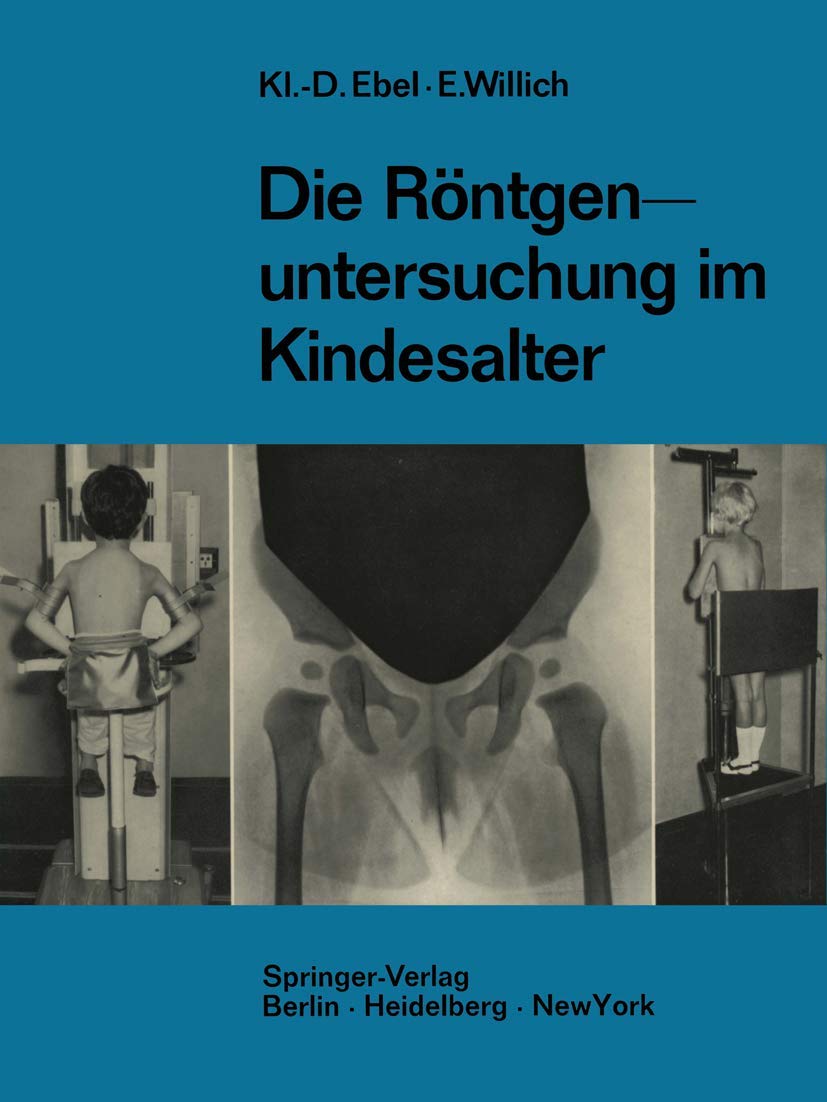 Buy Die Röntgenuntersuchung im Kindesalter: Technik und Indikation by Klaus-Dietrich Ebel & Eberhard Willich | Springer-Verlag | German Hardcover | 1968 Edition | Medical Radiology Textbook — BookShops.in