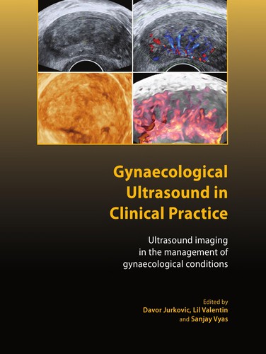 Buy Gynaecological Ultrasound in Clinical Practice: Ultrasound Imaging in Gynaecological Conditions by Davor Jurkovic, Lil Valentin, Sanjay Vyas - Royal College of Obstetricians and Gynaecologists Hardcover English 9781904752295 — BookShops.in