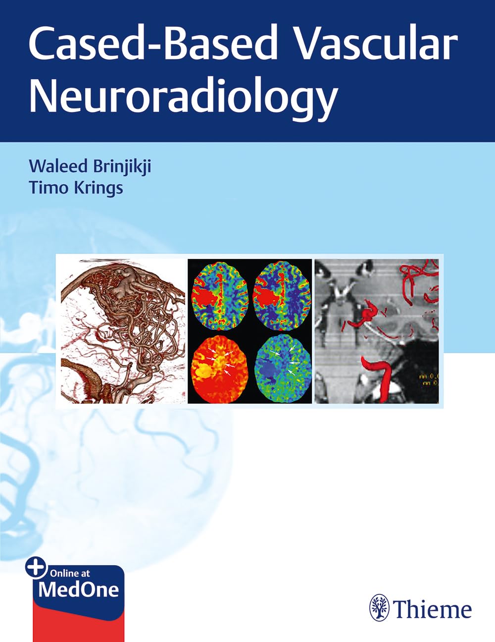 Buy Imaging in Neurovascular Disease: A Case-Based Approach by Waleed Brinjikji and Timo Krings | Thieme Medical Publishers | Hardcover | 1st Edition | Neurosurgery Textbook — BookShops.in