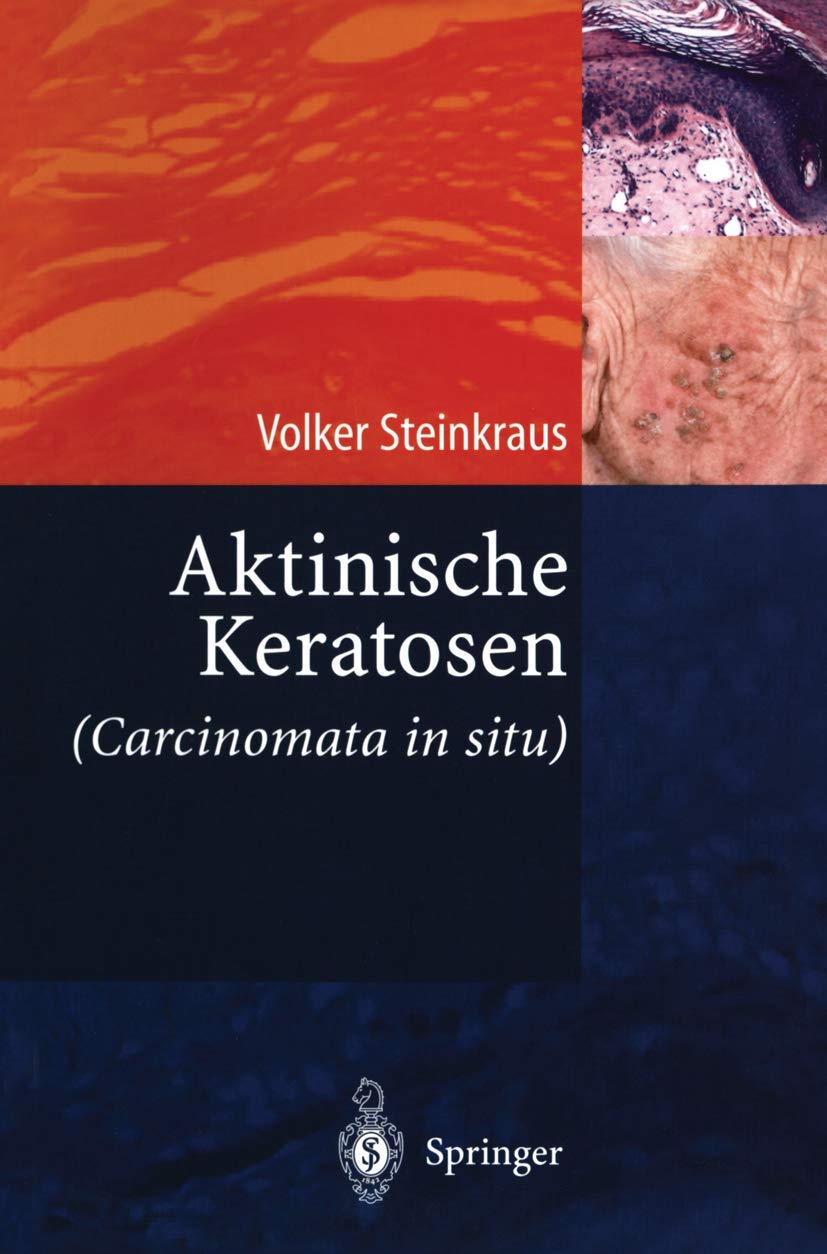 Buy Aktinische Keratosen (Carcinomata in situ) by Volker Steinkraus – Springer-Verlag Hardcover 2004 German Medical Textbook — BookShops.in
