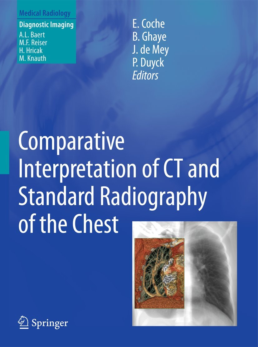 Buy Comparative Interpretation of CT and Standard Radiography of the Chest by Emmanuel E. Coche, Benoit Ghaye, Johan De Mey | Springer | English | Paperback | 1st Edition — BookShops.in